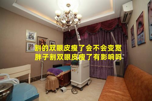 割的双眼皮瘦了会不会变宽 胖子割双眼皮瘦了有影响吗